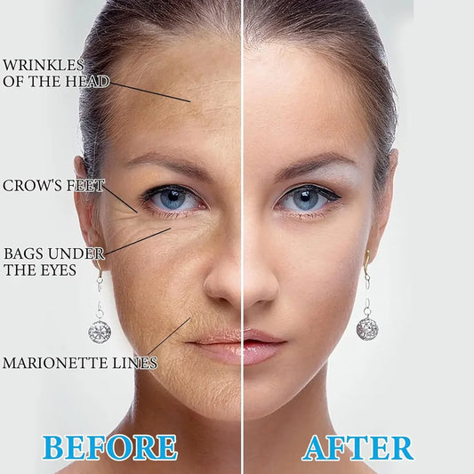 2x1 REAFIRMA Y REDUCE TU PAPADA Y ARRUGAS - Serum Botox con Colágeno