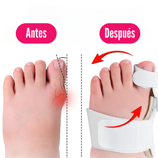 CORRECTOR DE JUANETES ORTOPEDICO