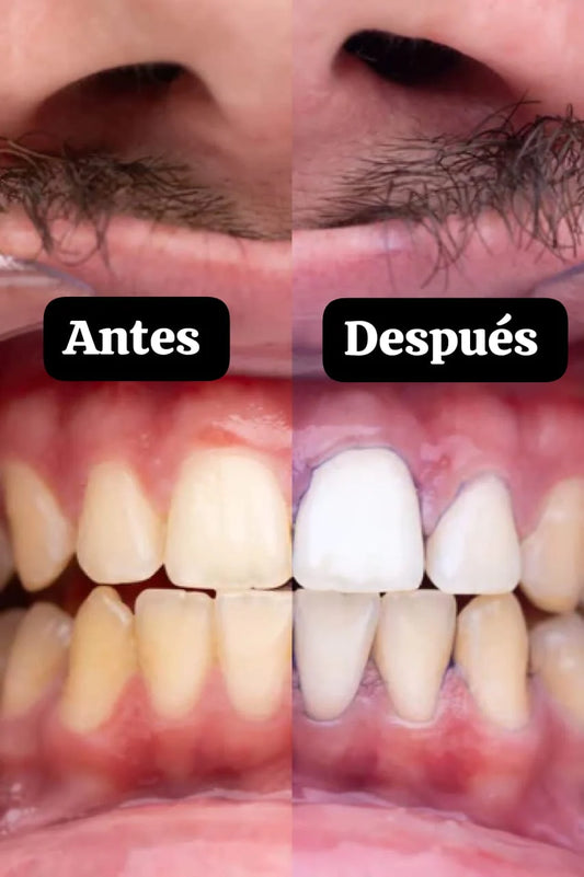 Pasta Morada BLANQUEADOR DENTAL 🦷