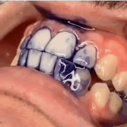 Pasta Morada BLANQUEADOR DENTAL 🦷